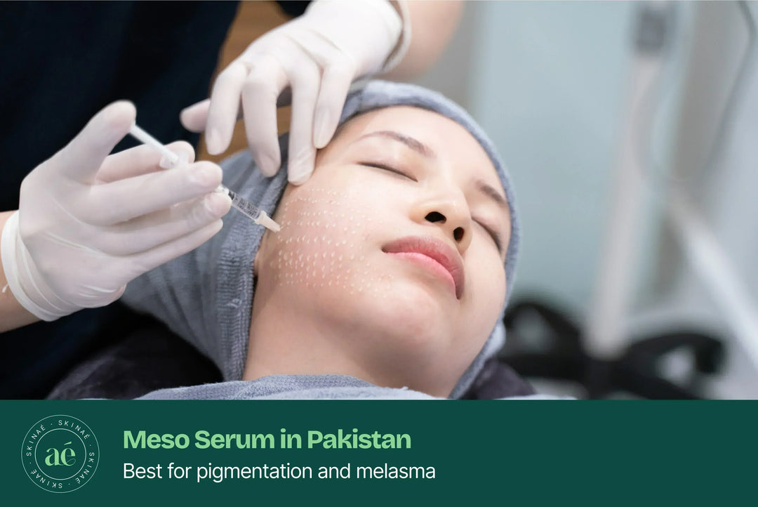 Microneedling with mesotherapy serum for skin brightening and dark spot treatment