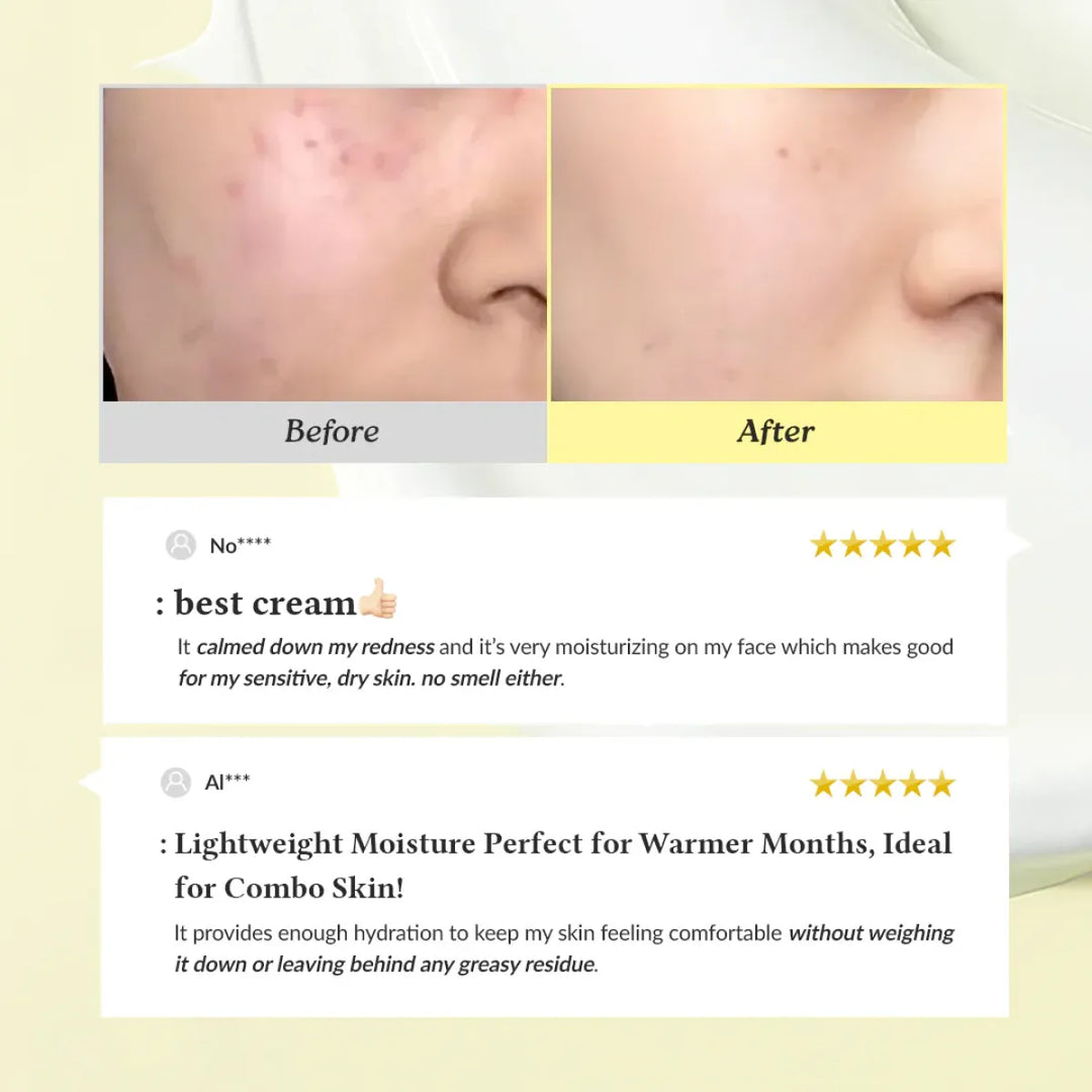 Dr Althea 345 Relief Cream 50ml calming moisturizer for sensitive skin  before and after - Made in Korea – Skinae