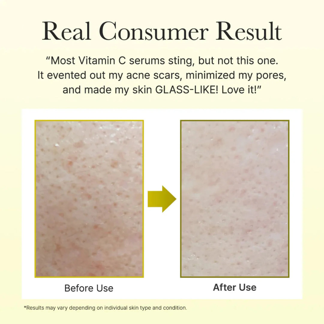 Arencia Vitamin C Booster Shot Serum (30ml) in Pakistan - Skinae