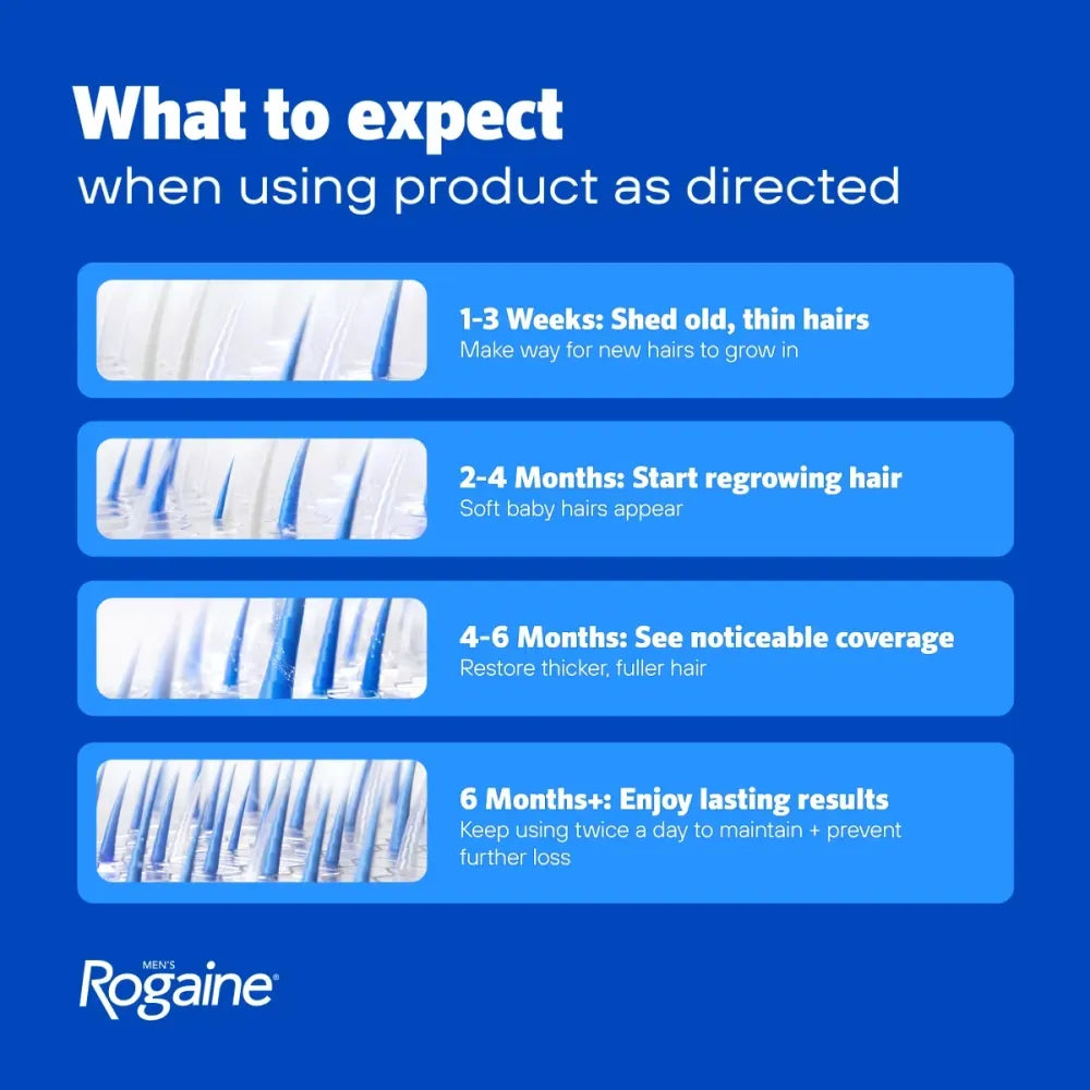 Blue informational graphic from Rogaine titled 'What to expect when using product as directed,' with four horizontal panels showing hair density progress and text about shedding, regrowing, noticeable coverage, and lasting results.