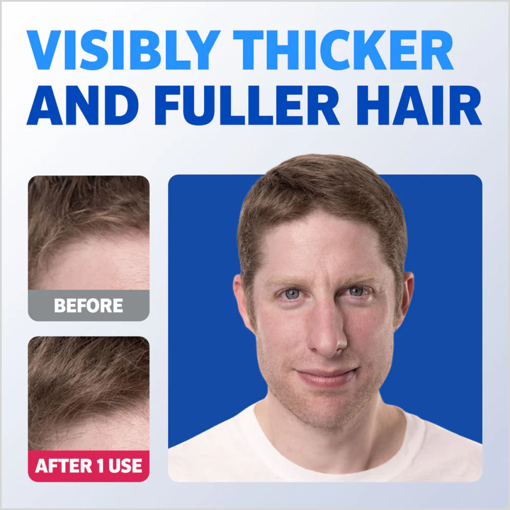 before and after image of ROGAINE® Hair Thickening 2 in 1 Shampoo + Conditioner - Skinae.pk