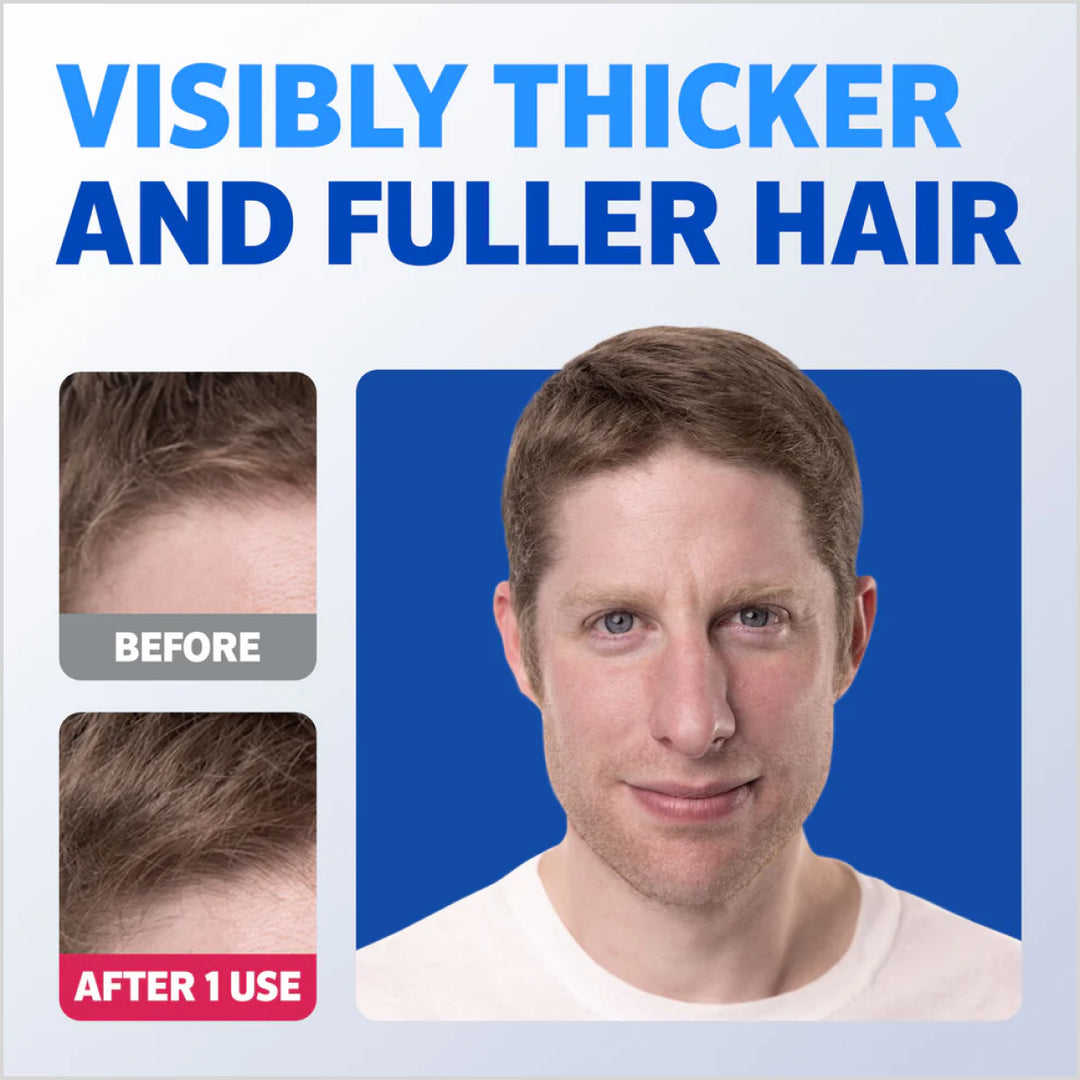 before and after image of ROGAINE® Hair Thickening 2 in 1 Shampoo + Conditioner - Skinae.pk