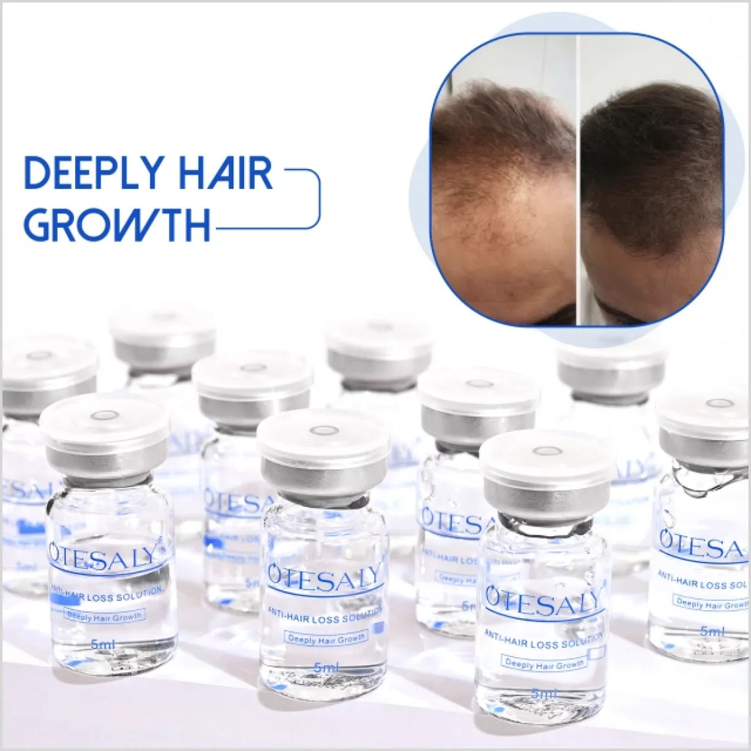 OTESALY Anti-hair Loss Solution - Mesotherapy for Hair - Before and after results - Skinae