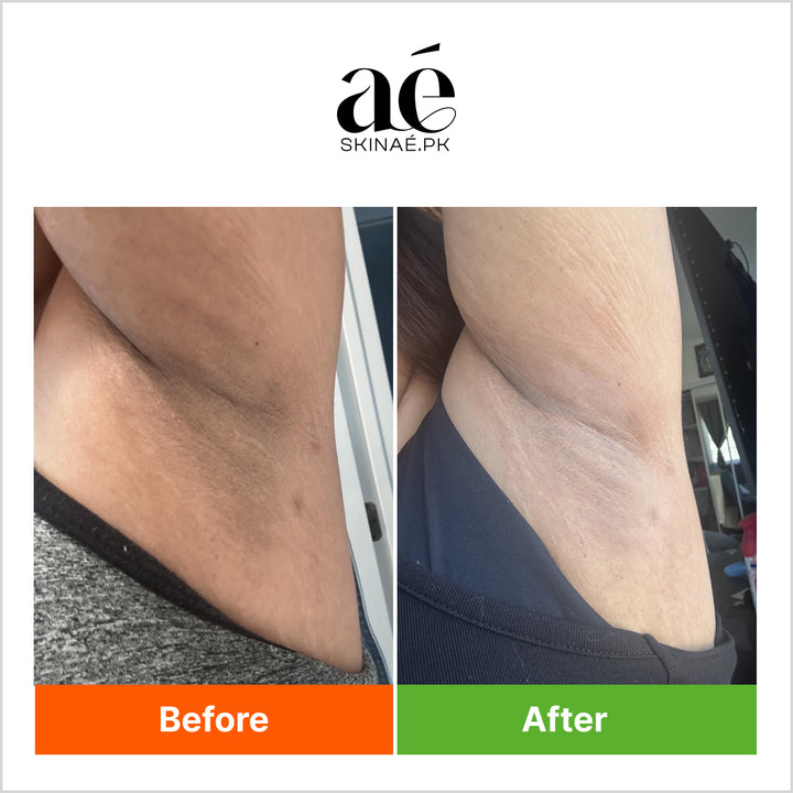 Original Palmer's Skin Success Anti-Dark Spot Fade Cream - USA Imported Palmer's