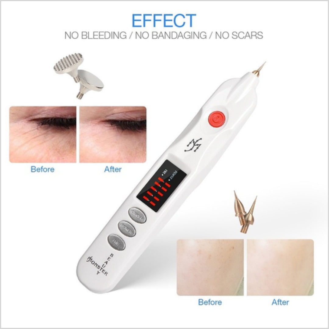Beauty Monster Plasma Pen professional skin tightening and wrinkle removal device - Skinae