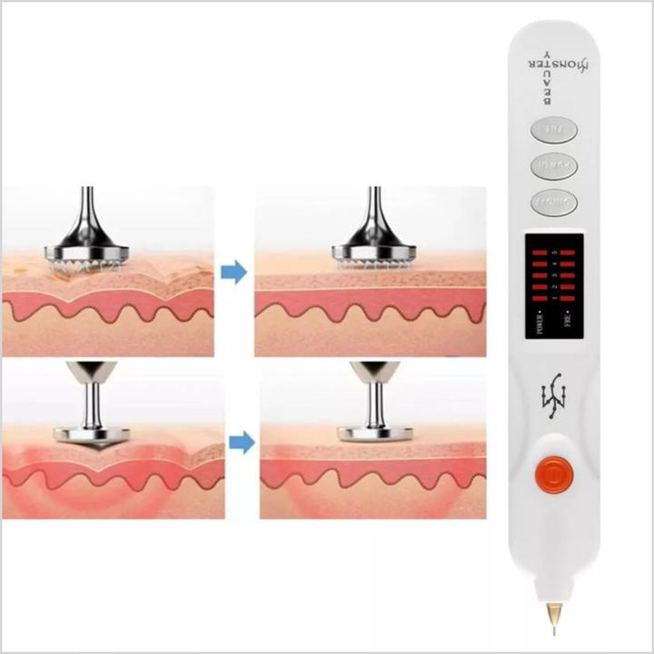 Beauty Monster Plasma Pen professional skin tightening and wrinkle removal device - Skinae